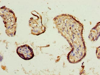 Polyclonal Rabbit anti-Human COBLL1 Antibody (IHC)