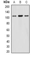 Polyclonal Rabbit anti-Human EIF3C / EIF3S8 Antibody (IF, WB)