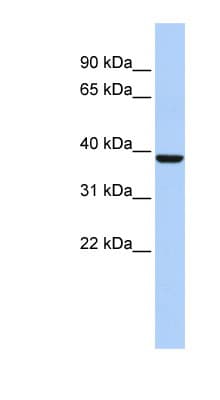 ALAD Antibody (N-Terminus)