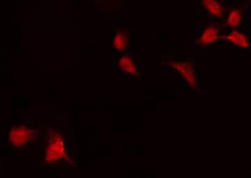Polyclonal Rabbit anti-Human RELA / NFKB p65 Antibody (phospho-Thr254, IHC, IF, WB)