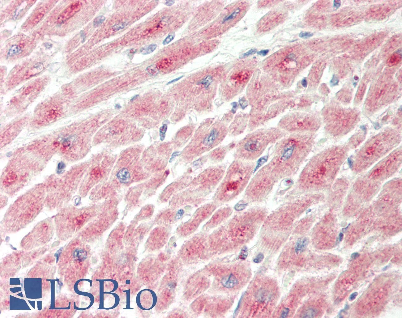 IGFBP2 / IGF-BP53 Antibody (aa215-264)