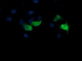 MAP2K3 / MEK3 / MKK3 Antibody (clone OTI3C3)