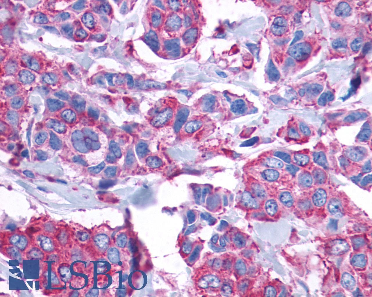 PathPlus™ GPR132 / G2A Antibody (Cytoplasmic Domain)