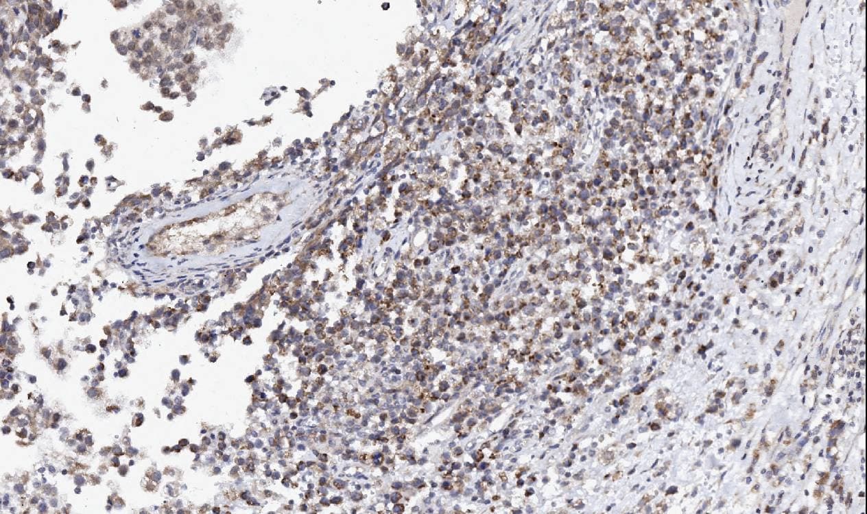 AZIN2 / Antizyme Inhibitor 2 Antibody