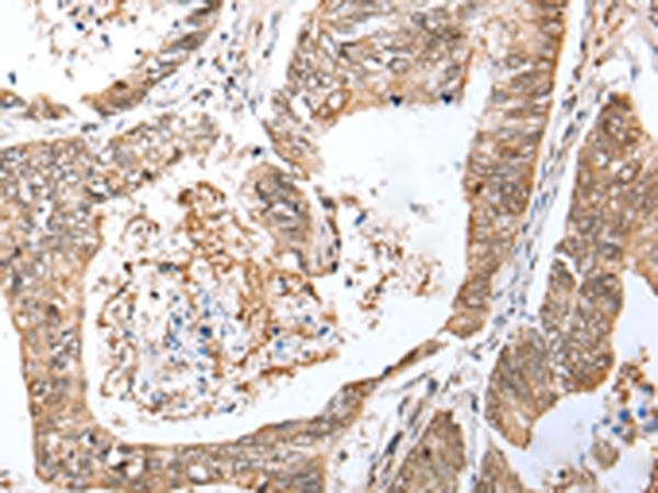 Polyclonal Rabbit anti-Human LRRC19 Antibody (IHC, WB)