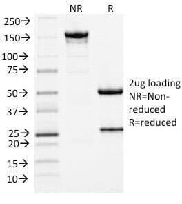 MCM7 Antibody (clone MCM7/1467, Ready-to-Use)