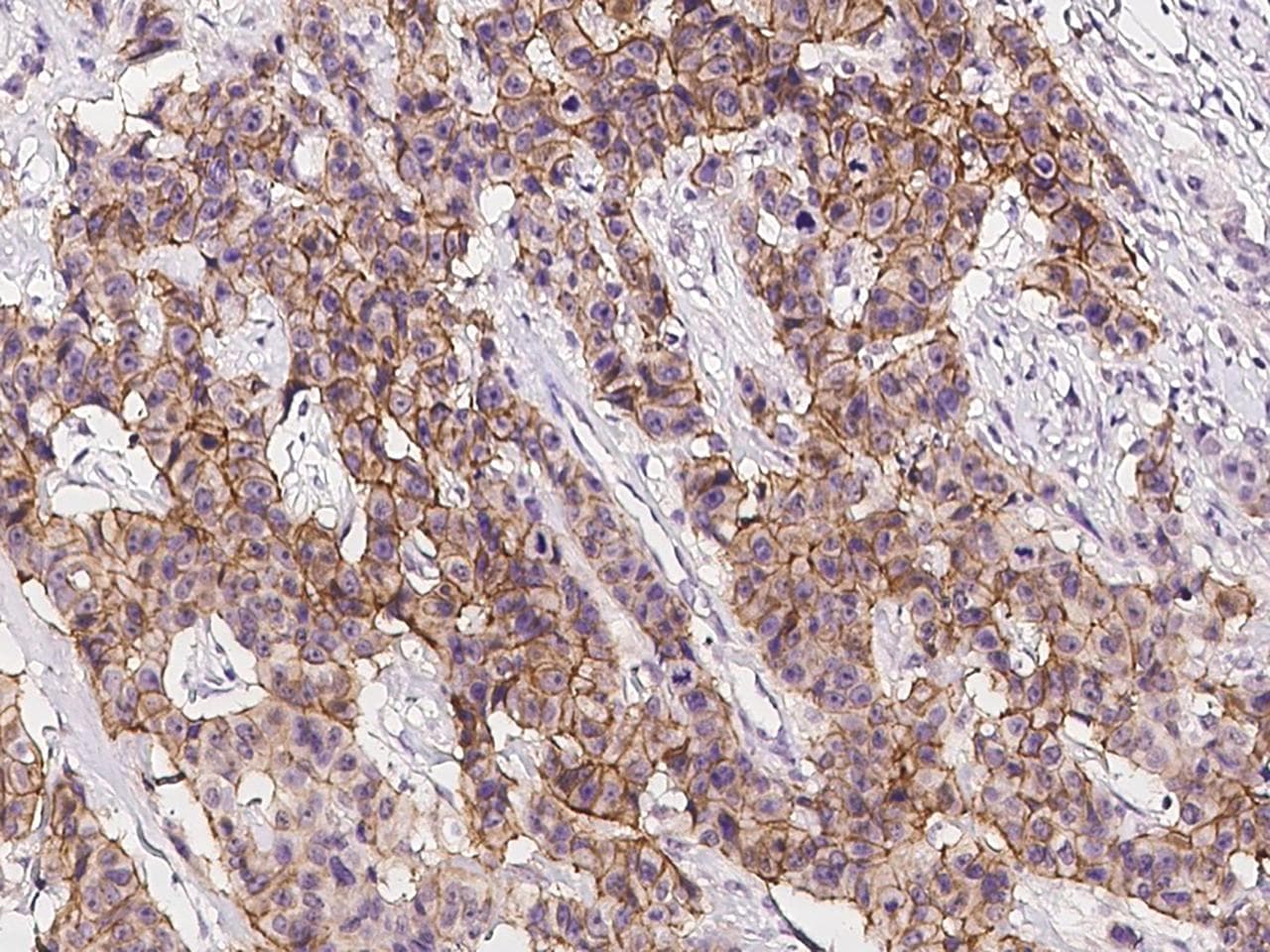 ERBB2 / HER2 Antibody