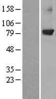 Human PRKCB / PKC-Beta Protein (Over-Expression Lysate Myc-DDK (Flag))