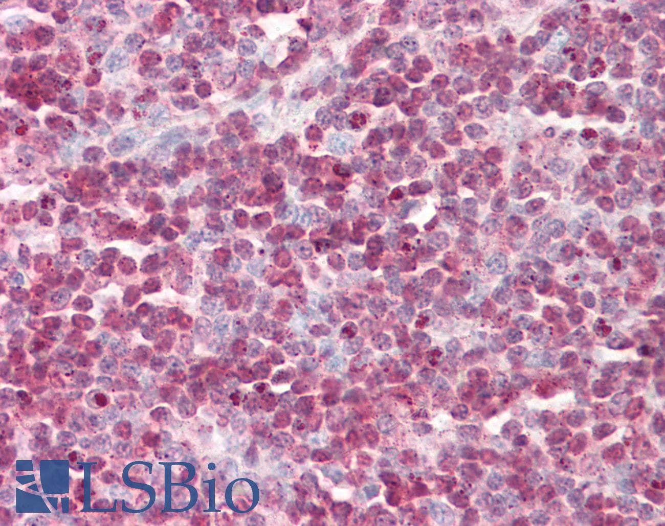 IHC-plus™ Polyclonal Rabbit anti-Human CSTB / Cystatin B / Stefin B Antibody (IHC, IF, WB)