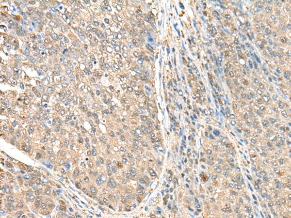 Polyclonal Rabbit anti-Human ASS1 / ASS Antibody (IHC, WB)
