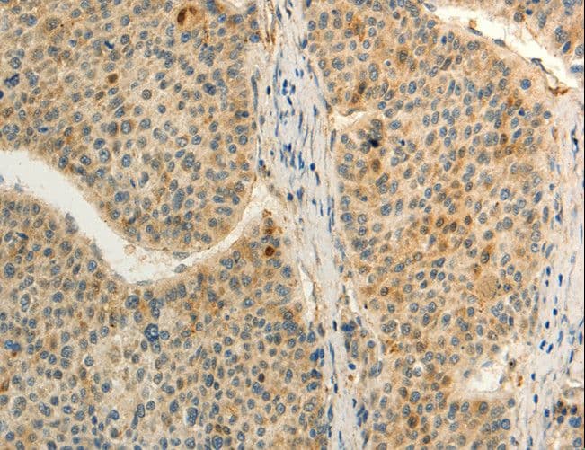 Polyclonal Rabbit anti-Human FZD8 / Frizzled 8 Antibody (IHC)