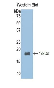 TCF20 Antibody (aa392-524)