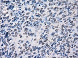 CYPOR / POR Antibody (clone OTI2E4)