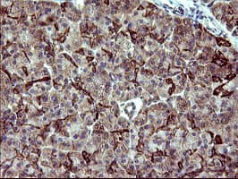 ACAA2 Antibody (clone OTI3H9)