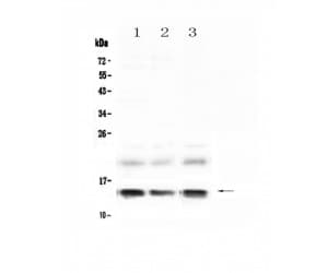 FABP1 / L-FABP Antibody