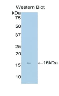 BAFF Receptor / CD268 Antibody (aa45-169)