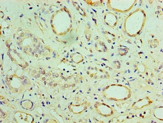 MIA40 / CHCHD4 Antibody (aa1-142)