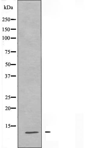 Polyclonal Rabbit anti-Human S100A7L2 Antibody (IF, WB)