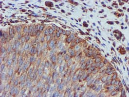 CYB5R3 / B5R Antibody (clone OTI1E8)