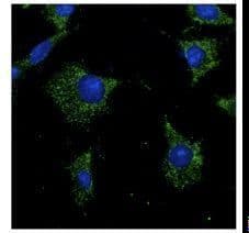 IHC-plus™ RAB7A / RAB7 Antibody (C-Terminus)