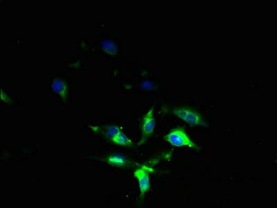 Polyclonal Rabbit anti-Human FXYD7 Antibody (IHC)