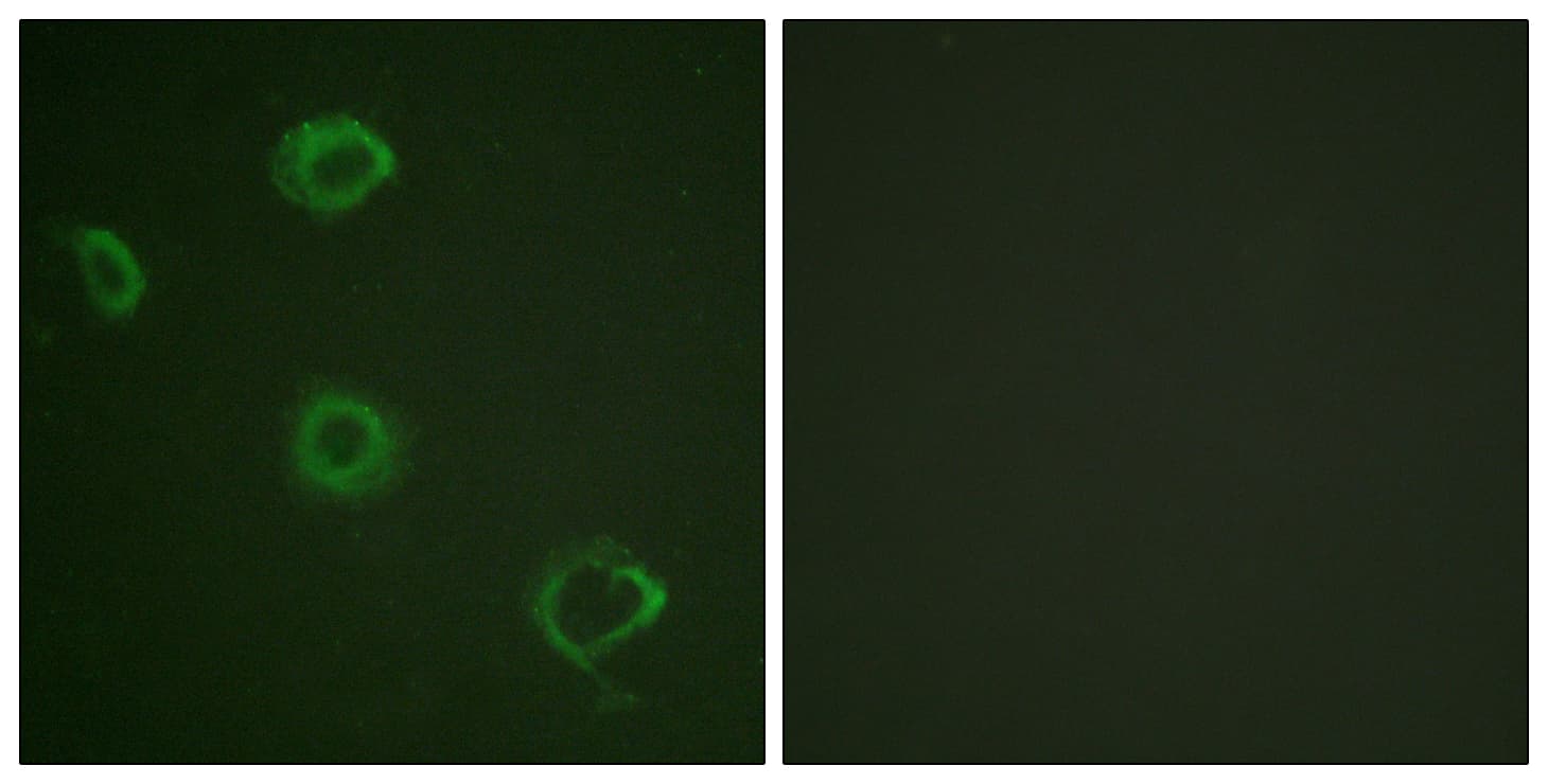 CD119 / IFNGR1 Antibody (phospho-Tyr457)