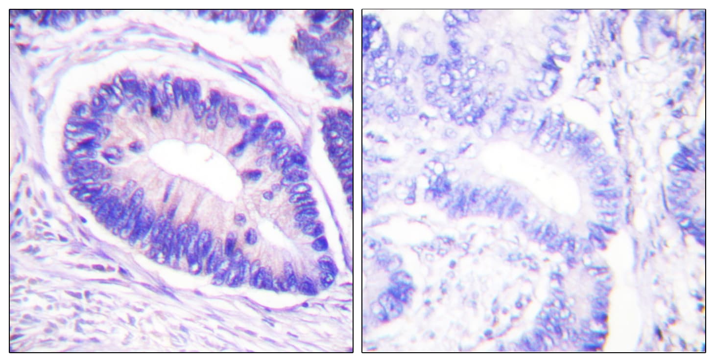PPP1R12A / MYPT1 Antibody (phospho-Thr853)