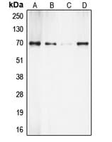 Polyclonal Rabbit anti-Human RPS6KB1 / P70S6K / S6K Antibody (C-Terminus, IHC, WB)