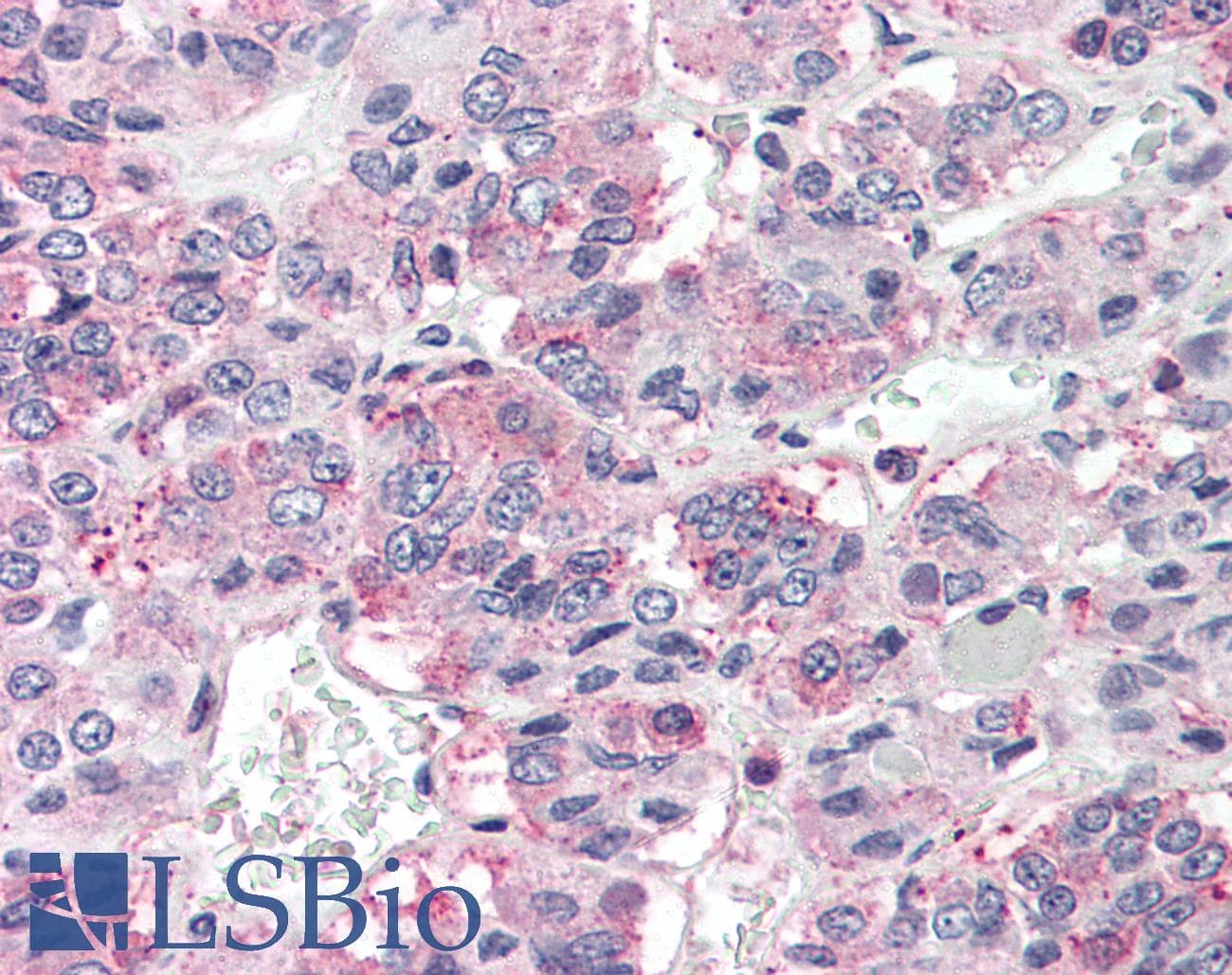 IHC-plus™ Polyclonal Rabbit anti-Human PRLHR / GPR10 Antibody (Extracellular Domain, IHC)