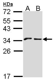 KLRC1 / NKG2A / CD159a Antibody (aa1-45)