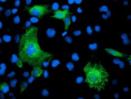 KATNB1 Antibody (clone OTI5F9)