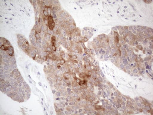 CAMK2B / CaMKII Beta Antibody (aa311-385, clone OTI8D9)