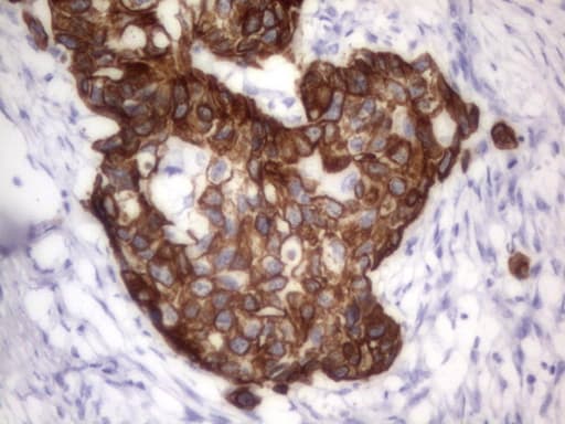 Acidic Cytokeratin Antibody (clone 3E10)