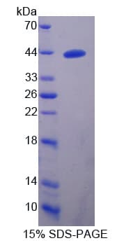 Human ADAMTS16 Protein (Recombinant His-T7)
