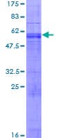 Human ARL10 Protein (Recombinant GST)