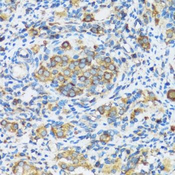 Polyclonal Rabbit anti-Human APOBEC3F / ARP8 Antibody (IHC)