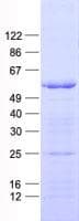 Human Complement C1RL Protein (Recombinant His, N-Terminal)