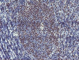 GBA3 / CBG Antibody (clone OTI3E8)