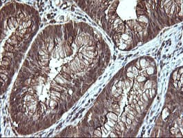 LGALS3 / Galectin 3 Antibody (clone OTI1A2)