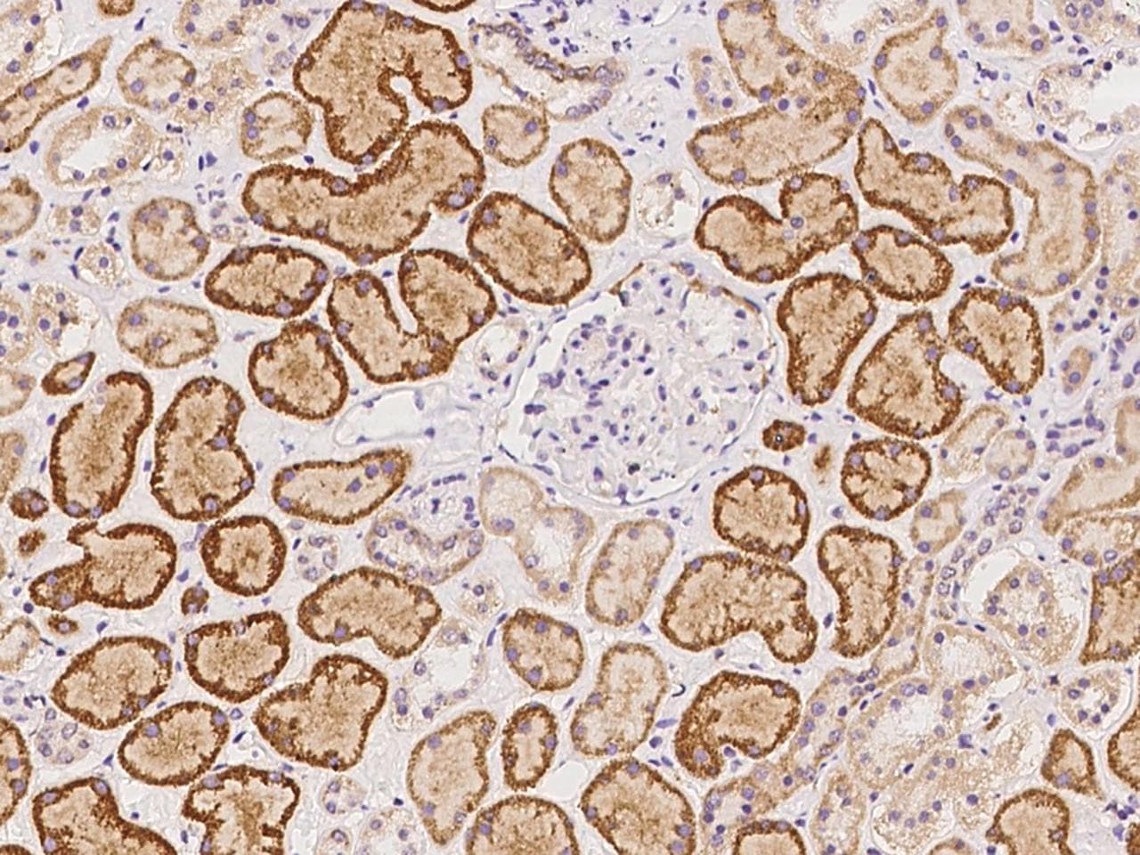 HSPH1 / HSP105 Antibody