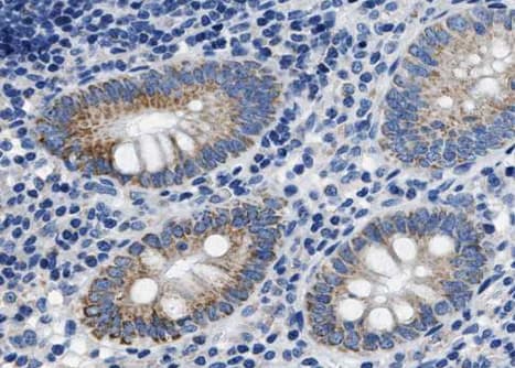 CASP8 / Caspase 8 Antibody (phospho-Ser347)