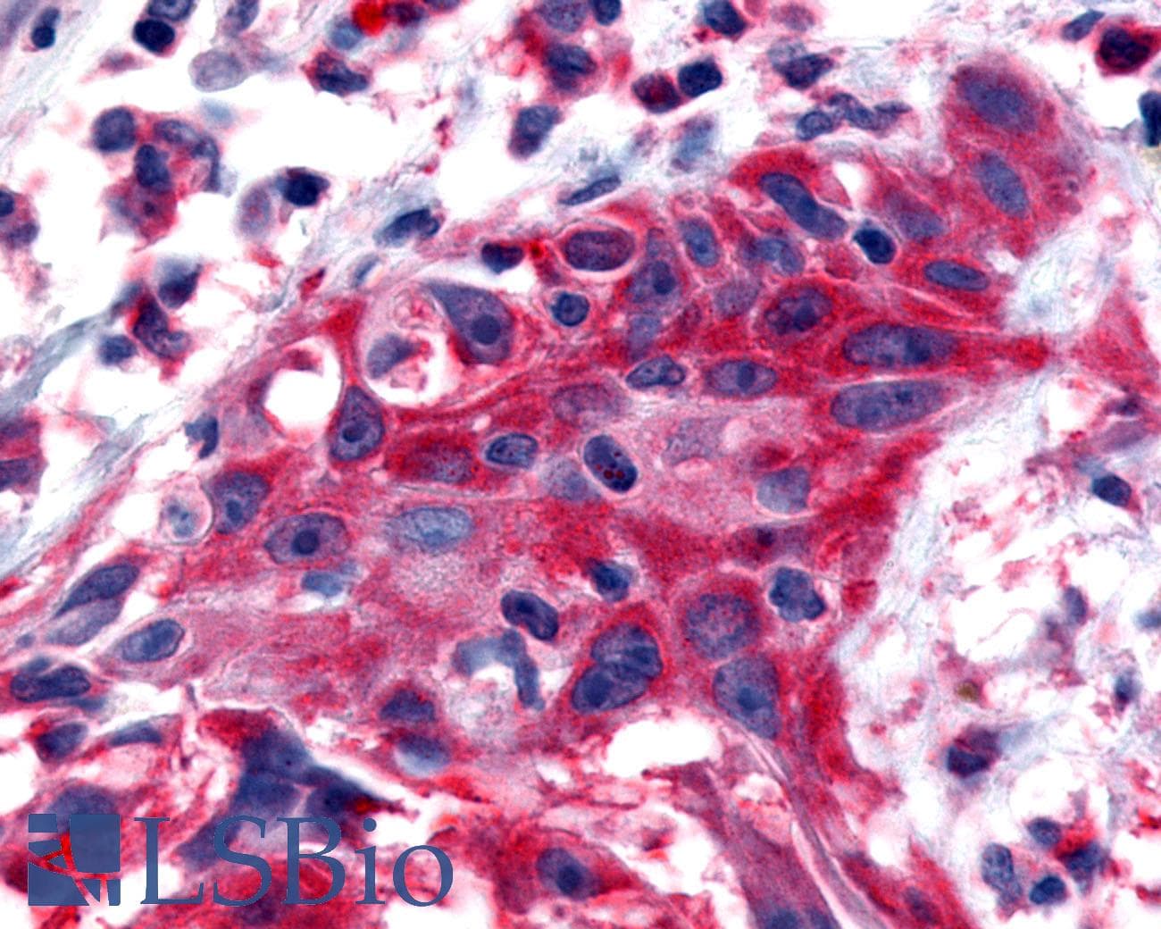 PathPlus™ NTSR2 / NTR2 Antibody (Extracellular Domain)