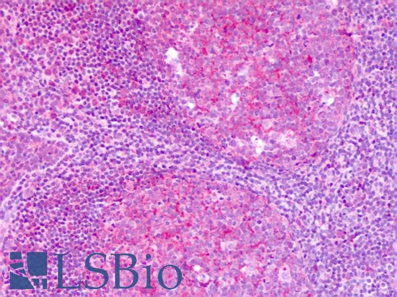 IHC-plus™ Polyclonal Rabbit anti-Human KISS1R / GPR54 Antibody (C-Terminus, IHC)