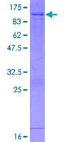 Human ABI2B / ABI2 Protein (Recombinant GST)