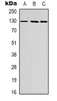 ZFPM2 / FOG2 Antibody (Internal)