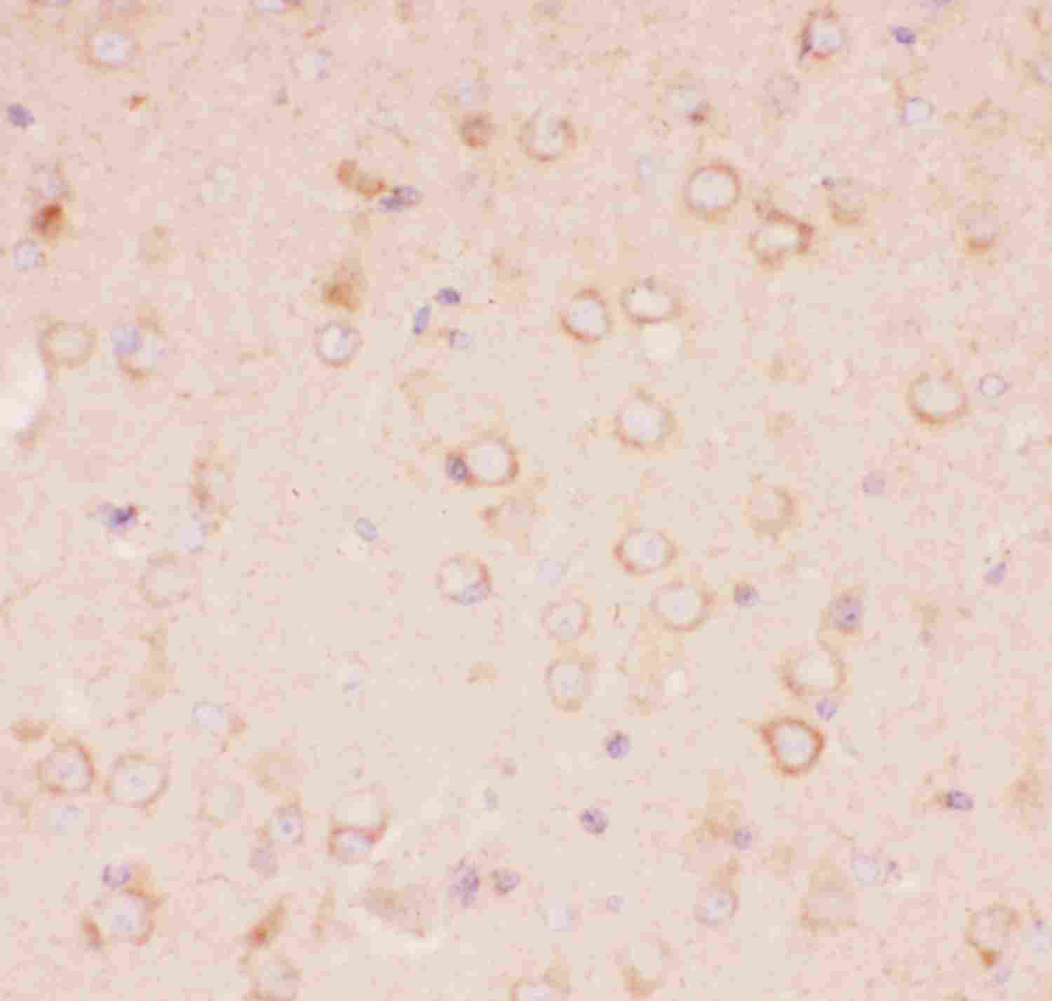 Tuberin / TSC2 Antibody (aa1611-1807)