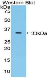 JAG2 / Jagged-2 Antibody (aa714-981, FITC)