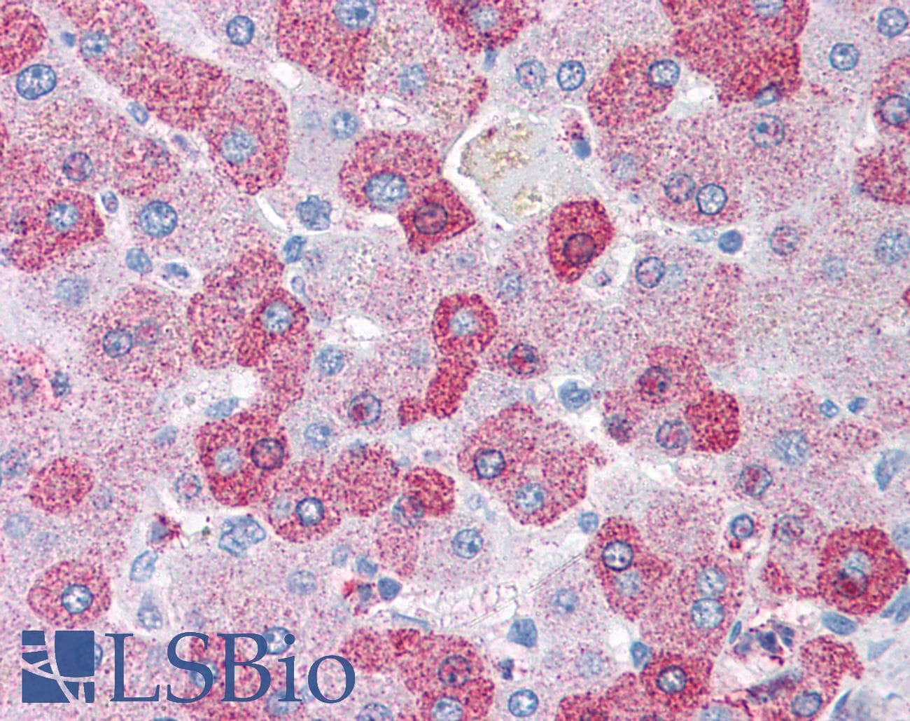 IHC-plus™ GCNT3 Antibody (Internal)