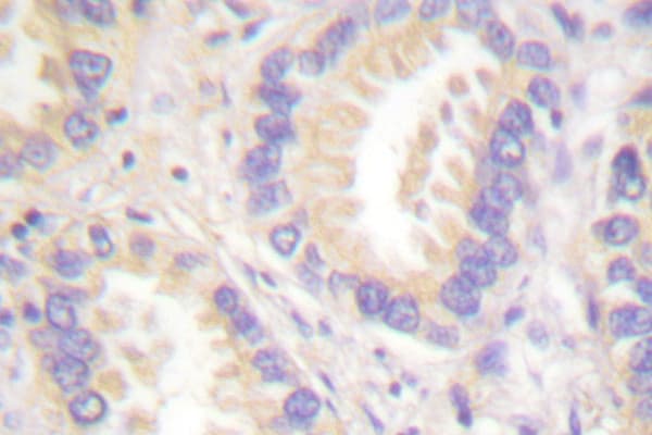 Polyclonal Rabbit anti-Human CASP8 / Caspase 8 Antibody (Thr341, IHC, WB)