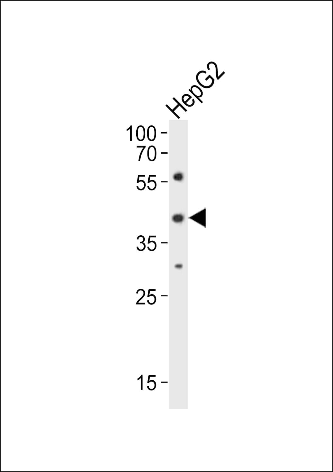 LHX1 Antibody (aa332-365)